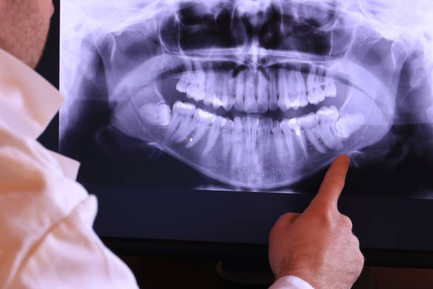  Ham Lake, MN Emergency Dentist Pros